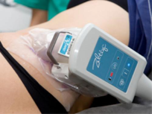 Сбросьте лишний вес на руках: 5 проверенных способов 03