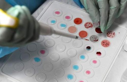 Стресс как причина лишнего веса: как избежать этой проблемы 04 Стресс как причина лишнего веса: как избежать этой проблемы 04